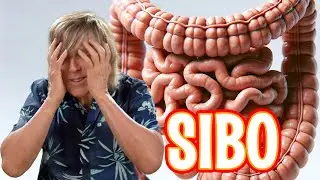 SIBO bloating gallstones kidney stones connection