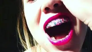 Grillz Грилзы как у Мадонны