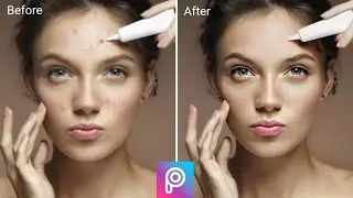 How To Remove Pimples In Picsart |Picsart Photo Editing Tutorial.