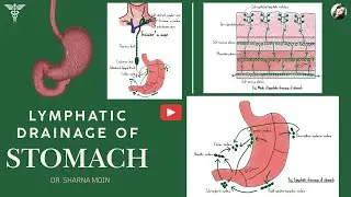 08 Stomach Lymphatic Drainage Virchow’s Node, Troisier’s Sign & More Explained