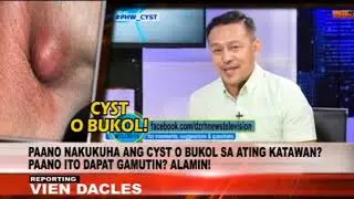 ALAMIN KUNG PAANO NABUBUO ANG CYST SA KATAWAN NG TAO!