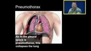 Introduction to Chest Tubes