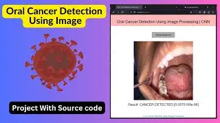 Oral Cancer Detection Using Image Processing | Deep Learning | CNN | Machine Learing | Source Code