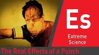 What Really Happens To Your Body When You Get Punched | Evil Knows