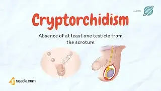 Cryptorchidism | Undescending Testicles | Causes, Pathology | Pediatrics Video Lecture