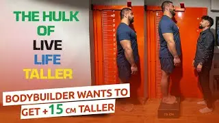 Body Builder wants to get +15 cm taller with limb lengthening surgery | The Hulk of Live Life Taller