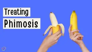 How to deal with a tight foreskin | Phimosis treatment