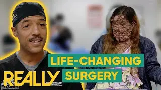 Dr Ryan's Tumour Removal Surgery Gives Patient A Life-Altering Transformation | Take My Tumour