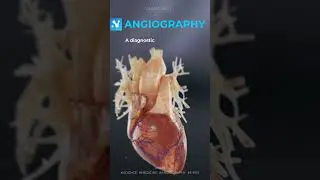 Angiography