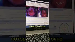 ✨Кандидат медицинских наук- Зарема Меджидовна при кольпоскопии обнаружила предрак😥