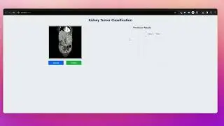 Building a Deep Learning Model for Kidney Disease Classification | CI/CD and EC2 Deployment 🚀