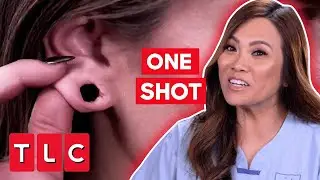 Dr. Lee Only Has ONE SHOT To Repair A Woman’s Earlobes! | Dr. Pimple Popper: This Is Zit