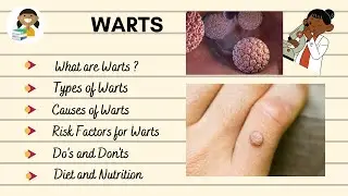 All About Warts: Symptoms, Types, Causes, Do's & Don'ts, Diet | Manna Kaur