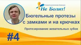 Бюгельные протезы с замками  и на крючках-кламмерах, протезирование жевательных зубов