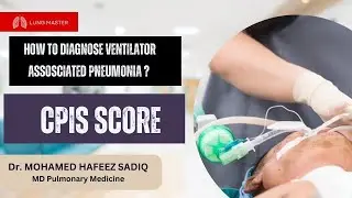 Ventilator Associated Pneumonia Prediction score- Modified CPIS score