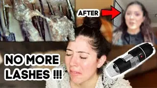 Removing my LASH EXTENSIONS after almost a year  *microscope*