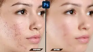 Face Retouching in Photoshop । Skin Retouching । Photoshop Tutorial