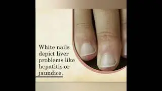 Infotmation about Nails #shorts #knowledgeclub