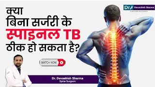 Can Spinal TB Be Cured Without Surgery? Spine TB Treatment In Delhi, India - Dr Devashish Sharma