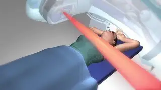 Active Breathing Coordinator (ABC) Device for Breast Cancer
