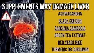 HEALTH IS WEALTH | SOME SUPPLEMENTS MAY DAMAGE THE LIVER