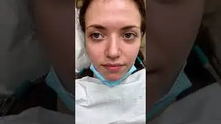 Dental trauma #accident#pain #tiktok #video #viral #trending #fyp #dentist #youtubeshorts #short