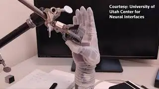 Star Wars inspired prosthetic lets amputee 'feel' again Video Reuters