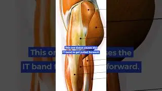 Most common cause of Knee Pain