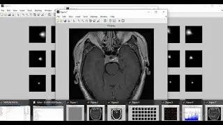 Brain Tumor Classification using HYBRID PCA-NGIST and RELM