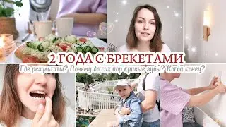 2 ГОДА С БРЕКЕТАМИ / ПОЧЕМУ ДО СИХ ПОР КРИВЫЕ ЗУБЫ? РЕЗУЛЬТАТЫ ЛЕЧЕНИЯ 🦷
