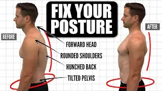 How To FIX Your Posture | 10-Minute Daily Routine