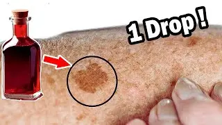 1 DROP of This Oil Makes AGE SPOTS DISAPPEAR Overnight!