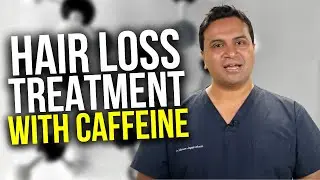 The Role of Caffeine in Hair Loss