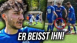 KREISLIGA SPIEL ESKALIERT VÖLLIG! UNSER SPIELER WIRD GEBISSEN!