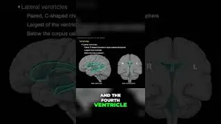 Exploring the Lateral ventricles #shorts  #science #anatomy #doctor