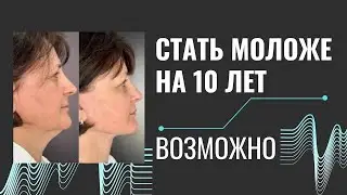 Помолодеть на 10 лет. Как воплотить мечту?