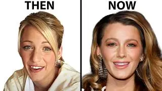 Blake Lively's NEW FACE | Plastic Surgery Analysis