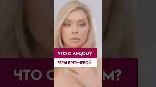 Что случилось с лицом Веры Брежневой?