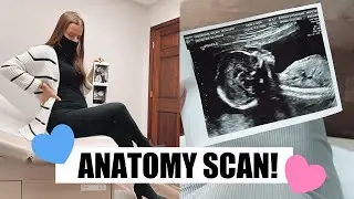 ANATOMY SCAN | 18 WEEKS ULTRASOUND