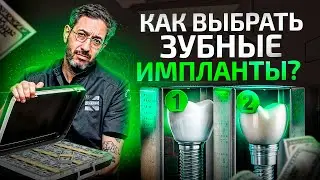 Какие зубные импланты выбрать? Лучшее, что можно поставить сейчас!