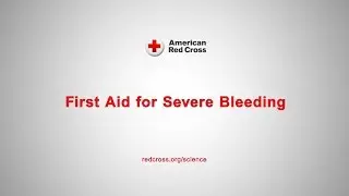 First Aid for Severe Bleeding