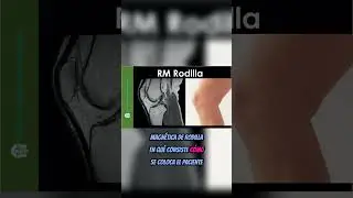 Resonancia Magnética de Rodilla #shorts