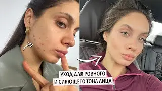 УХОД, КОТОРЫЙ СПАСАЕТ МОЮ КОЖУ | ЭФФЕКТИВНАЯ БОРЬБА С ПОСТАКНЕ