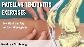 Patellar Tendonitis Exercises (Jumper's Knee)