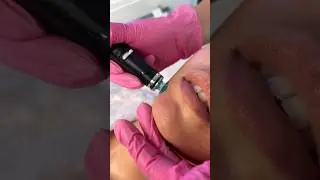 Бережный уход и омоложение кожи без следов и шелушений🔥