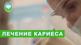 Лечение кариеса в стоматологической клинике доктора Осиповой