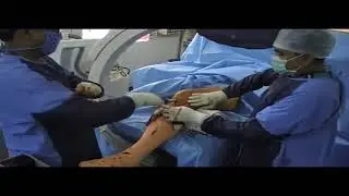 MOA 52 Shivashankar Multi lock nailing