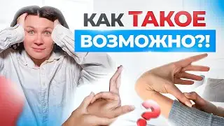 Гипермобильность суставов и ДИСПЛАЗИЯ | Почему ОПАСНО переразгибать суставы и как ЭТО исправить?