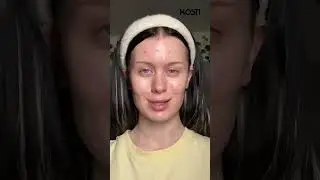 Даша Дошик расплакалась из-за проблемной кожи💔 