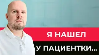 Шокирующая находка! Опасное образование у пациентки - не пропустите! || Проктолог Евпатория, Саки